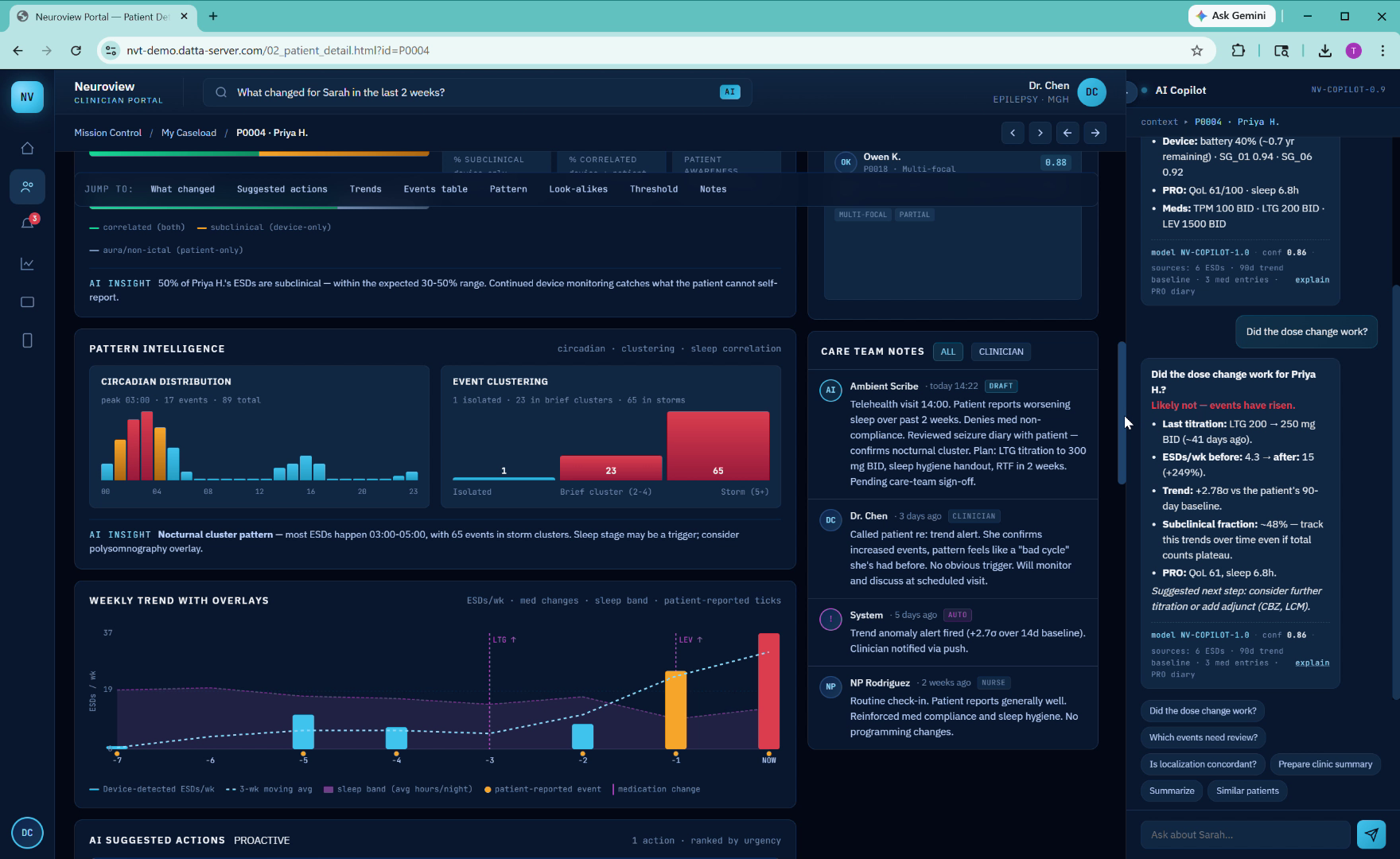 Clinician decision support with explainable AI recommendations